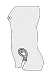schematic drawing of pregnancy
